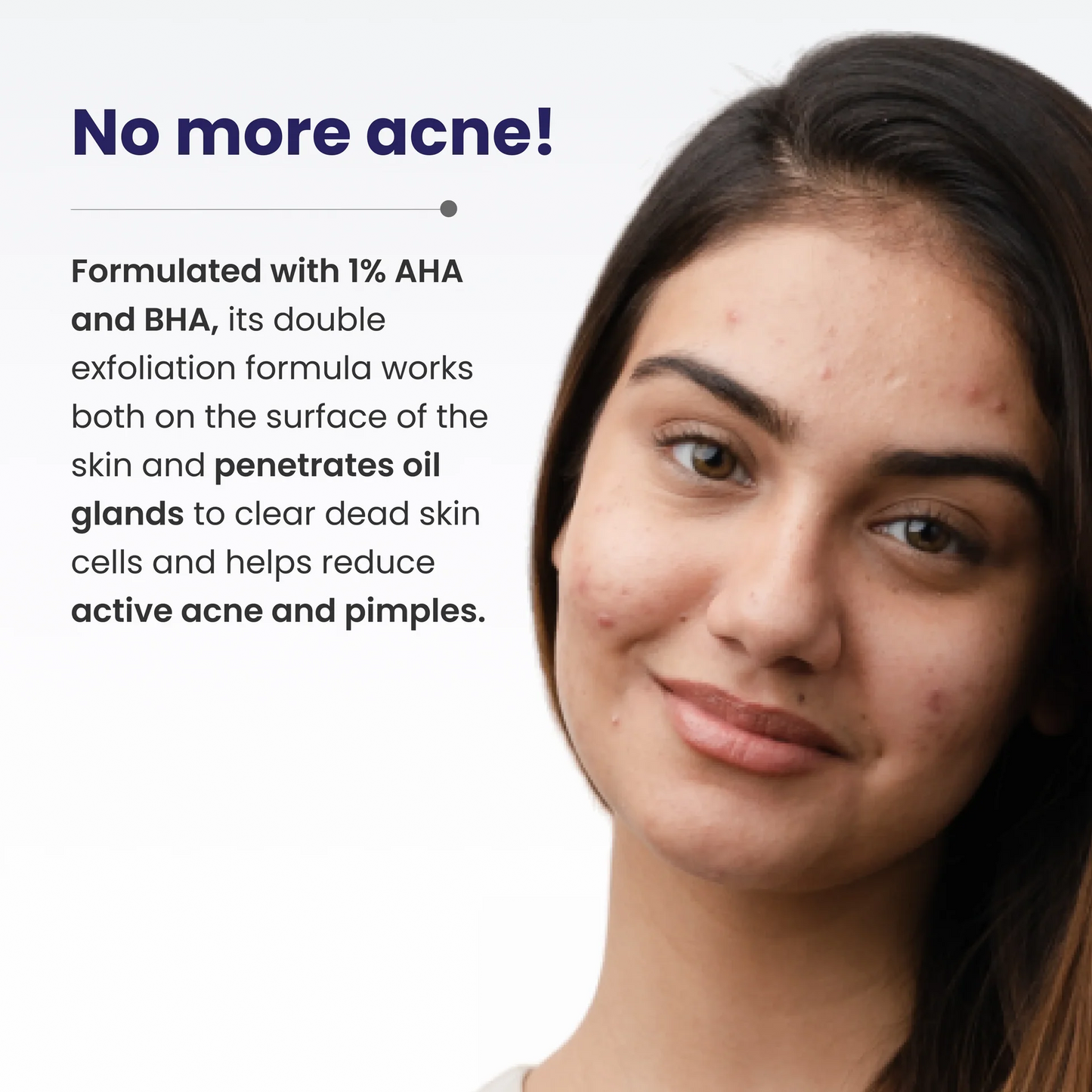 Re'equil Acne Clarifying Gel (20g)
