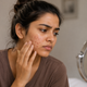 The Best Facewash for Acne in siyara beauty
