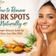 How to Remove Dark Spots Naturally (Simple Skincare Guide for Clear, Even Skin 2026)