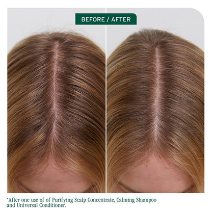 Biolage Scalp Sync Purifying Concentrate (200ml)