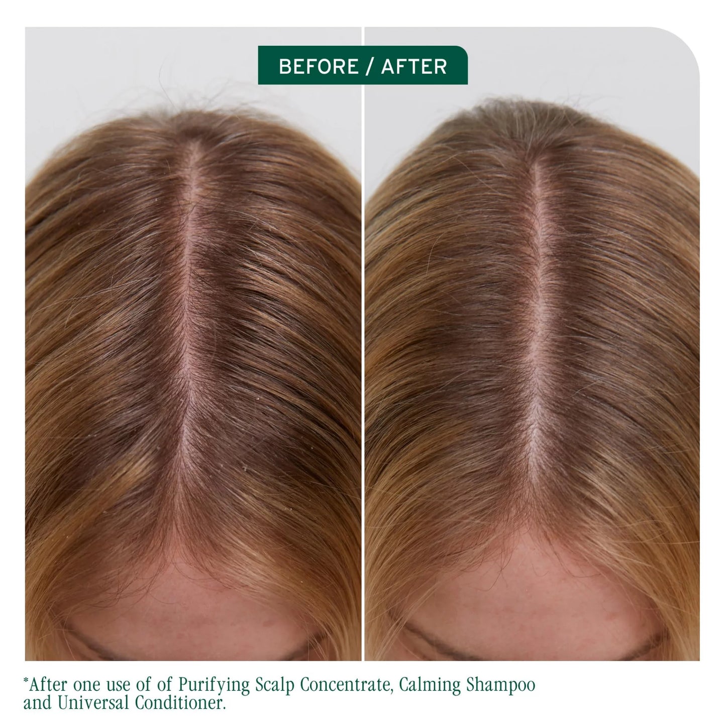 Biolage Scalp Sync Calming Shampoo (1000ml)