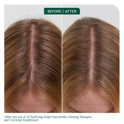 Biolage Scalp Sync Calming Shampoo (1000ml)