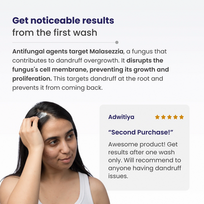 Re'equil Pre Wash Anti-Recurrence Dandruff Lotion