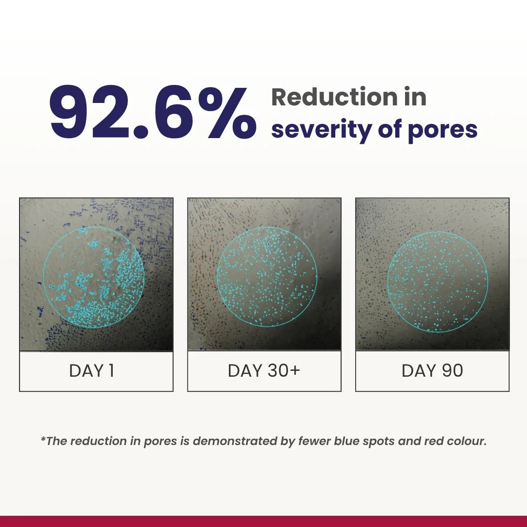 Re'equil 0.3% Retinol Night Cream (30 g)