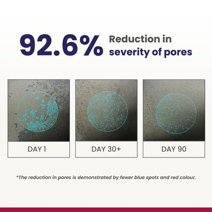 Re'equil 0.3% Retinol Night Cream (30 g)