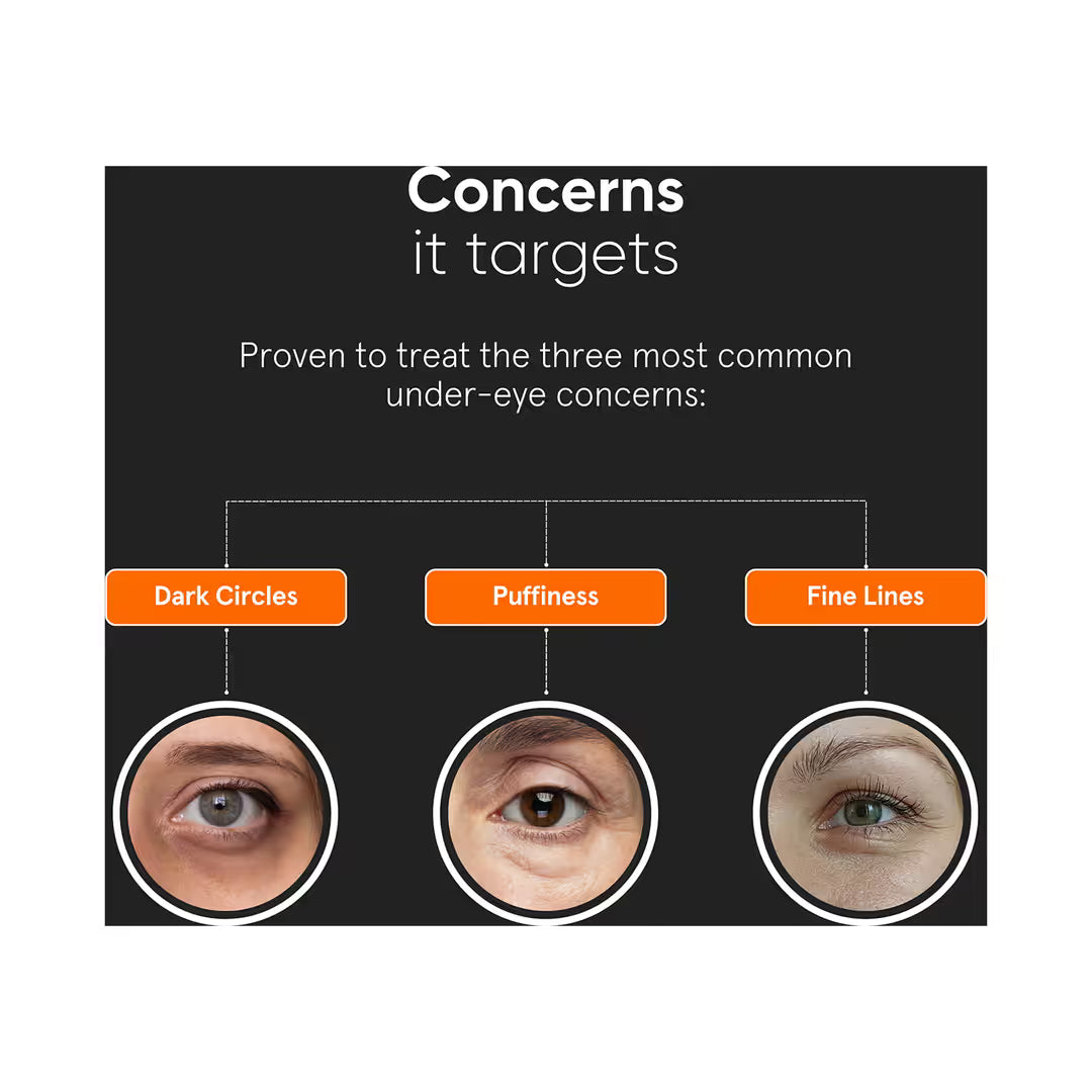 Minimalist Vitamin K + Retinal 01% Under Eye Cream (14 gm)