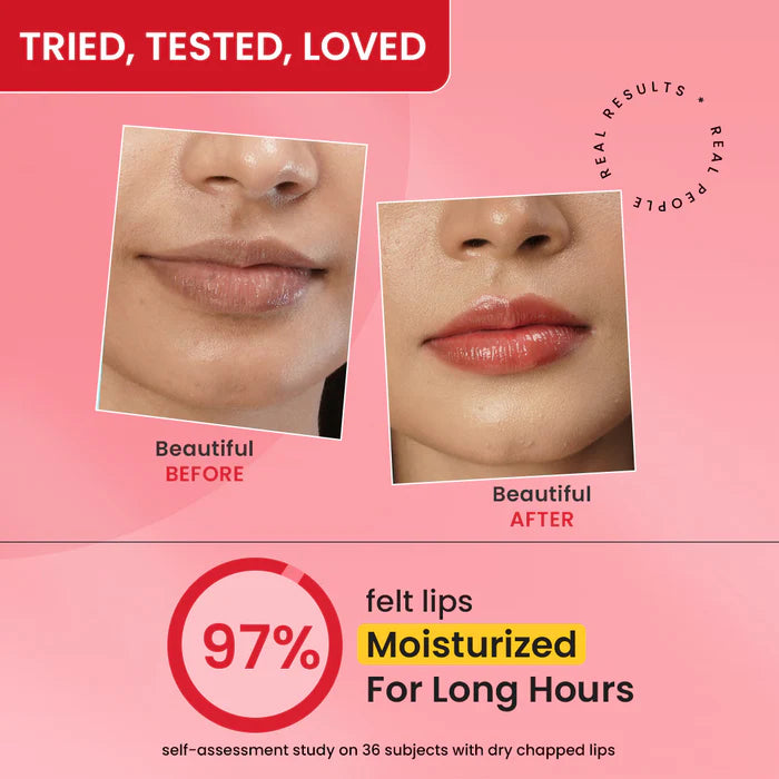 Dot & Key Gloss Boss Lip Balm SPF 50+ PA+++ With Vitamin C + E (12 g)