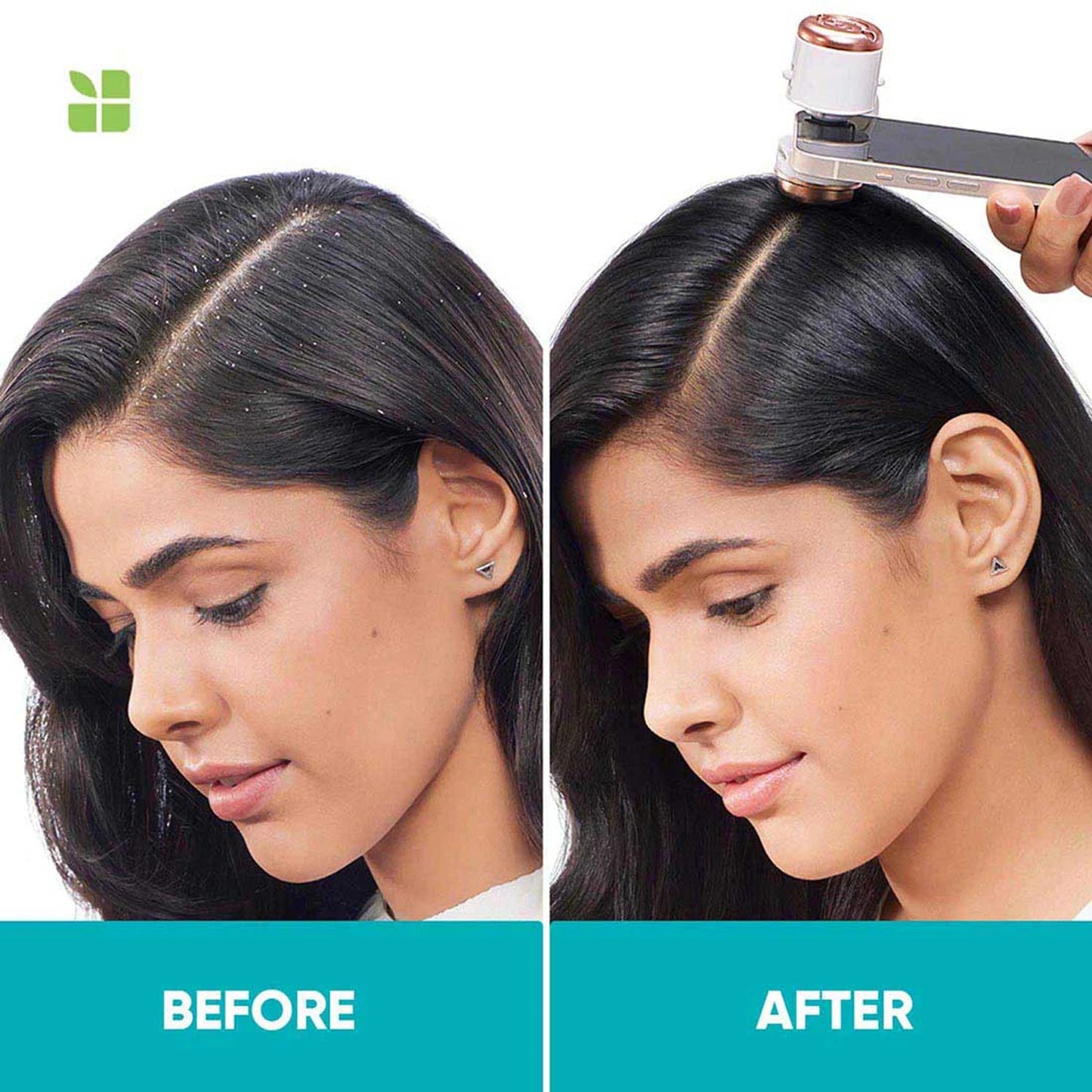BIOLAGE SCALPPURE Anti-Dandruff Shampoo, 72 HR Scalp Detox (400ml)