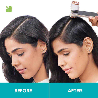 BIOLAGE SCALPPURE Anti-Dandruff Shampoo, 72 HR Scalp Detox (400ml)
