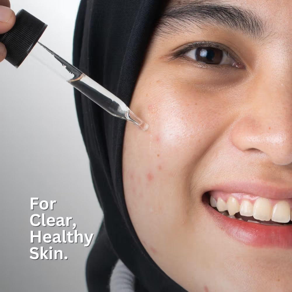 Minimalist 10% Niacinamide Face Serum With Matmarine + Zinc For Reducing Oil & Blemishes (30ml)