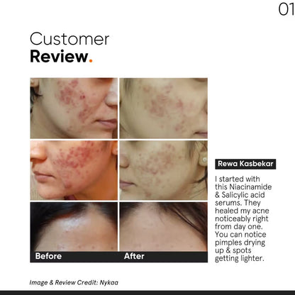 Minimalist 2% Salicylic Acid Face Serum For Blackheads & Whiteheads (30ml)