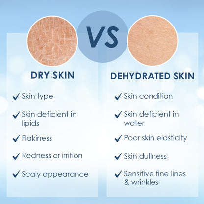 Cetaphil Optimal Hydration Daily Cream, Lightweight, Skin Barrier Protection with Hyaluronic Acid (50 g)