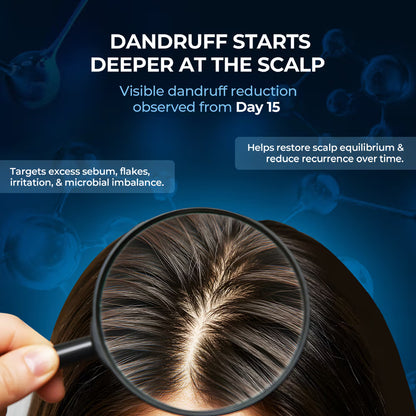Streax Professional Anti Dandruff Hair Mask (200g)
