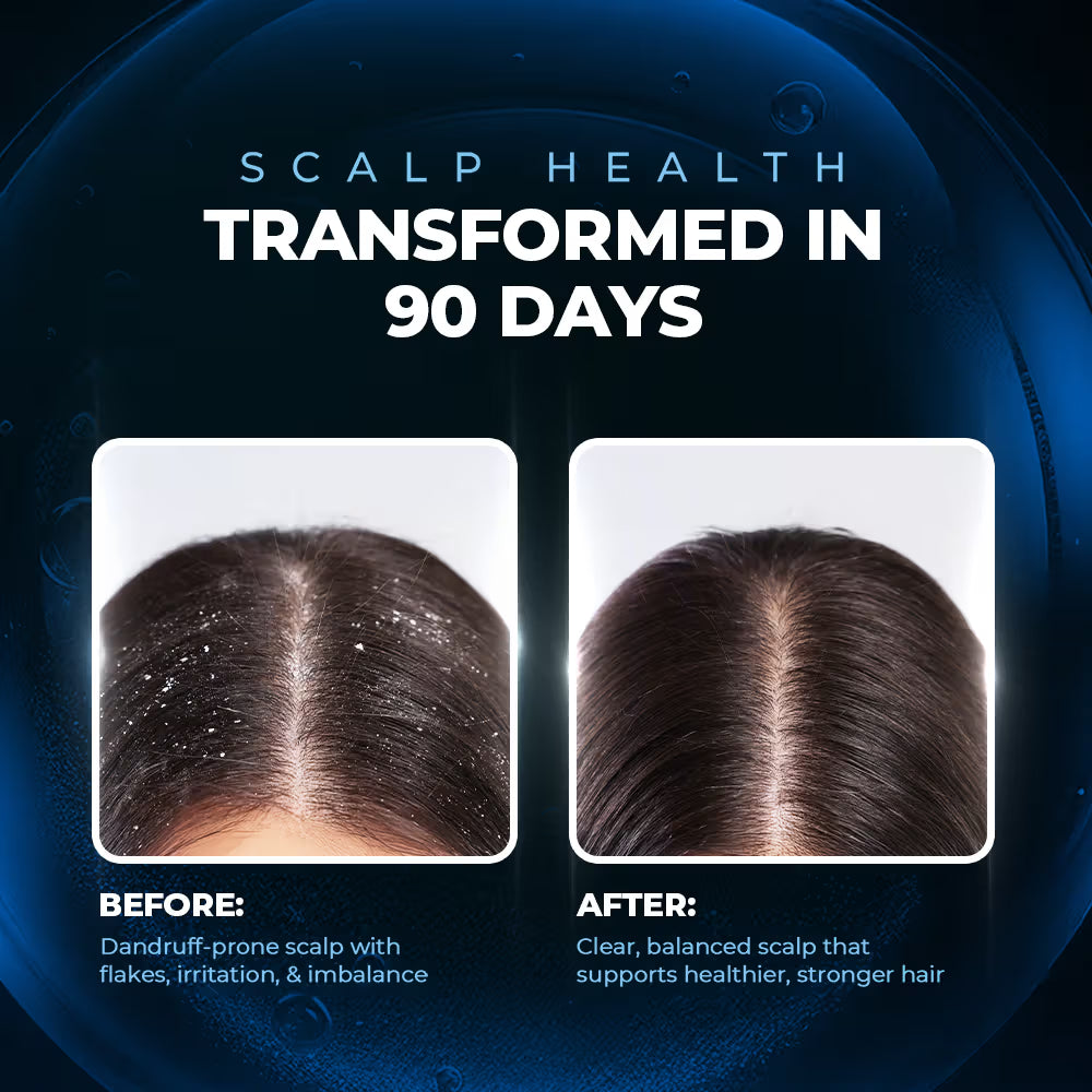 Streax Professional Anti Dandruff Hair Mask (200g)
