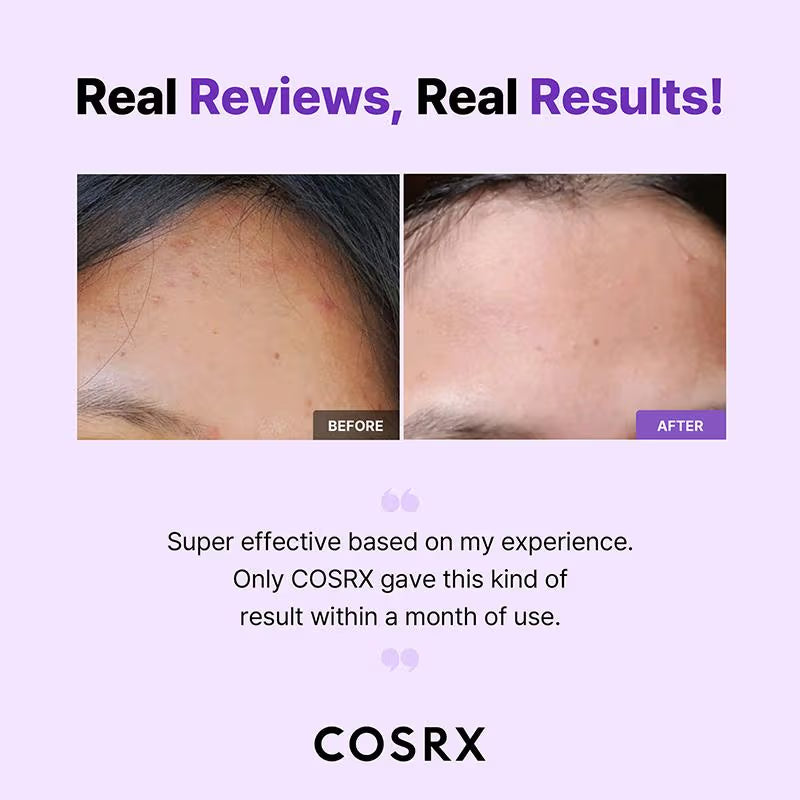 COSRX AHA/BHA Clarifying Treatment Toner (150ml)