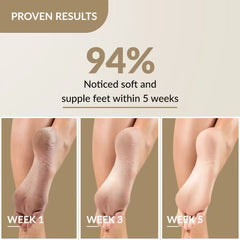 Foobetik Foot Cream | With Natural Emollients to Treat All Foot-Related Problems(100g)