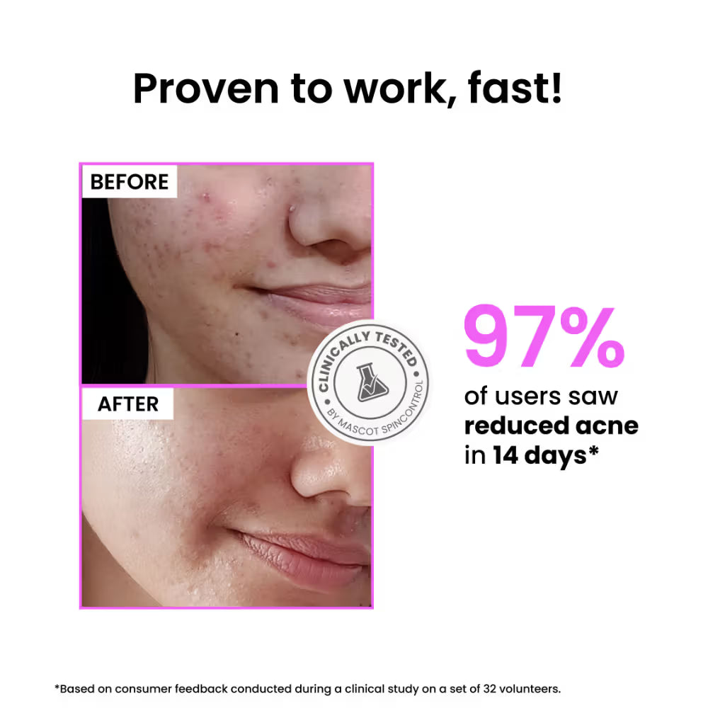 Foxtale 12% Niacinamide Serum with Azelaic Acid for Oil Control & Brightening (30 ml)