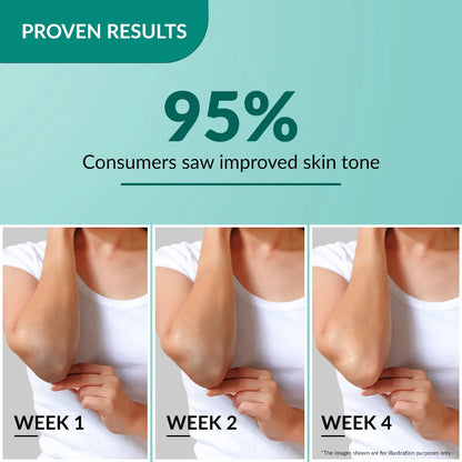 Fix Derma  Nigrifix Cream | A patented solution to treat hyperpigmentation(100g)