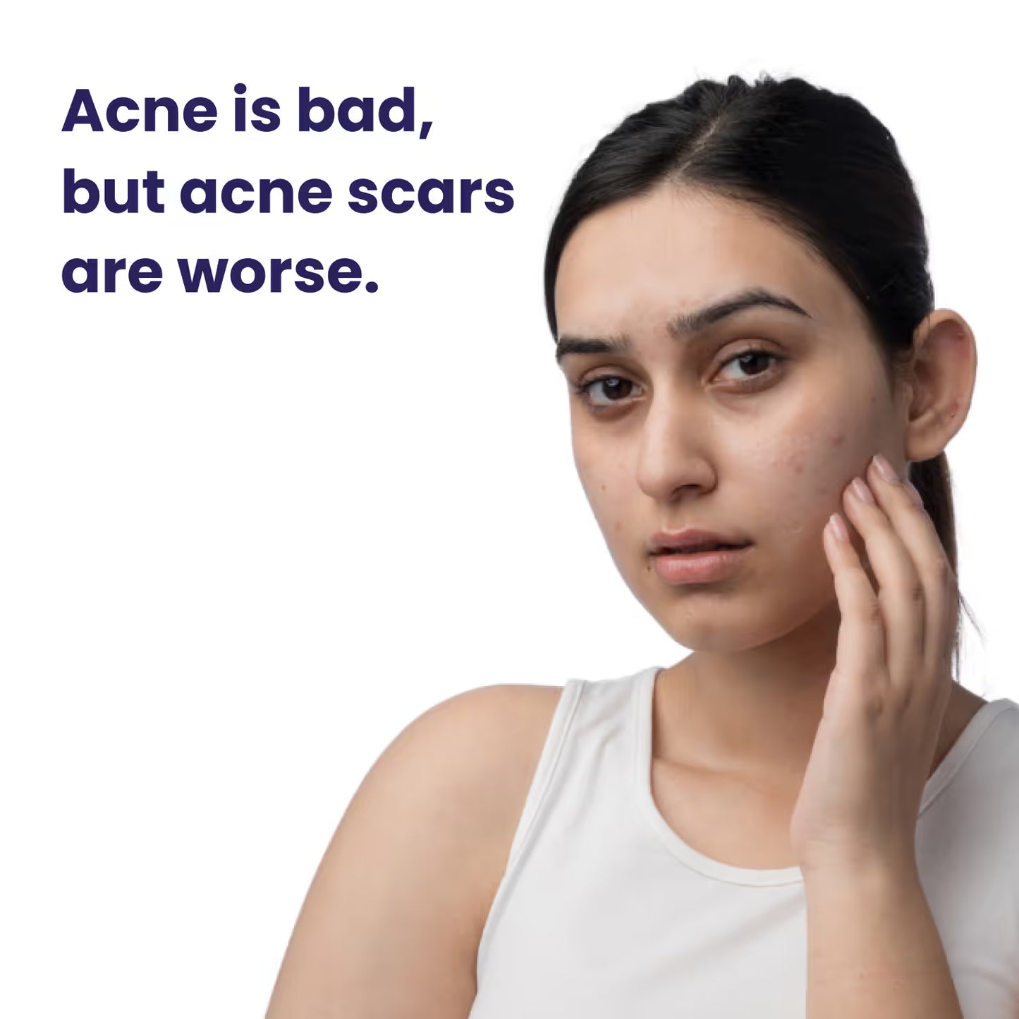 Re'equil Pitstop Blue Niacinamide Serum For Acne Scars & Marks (25ml)