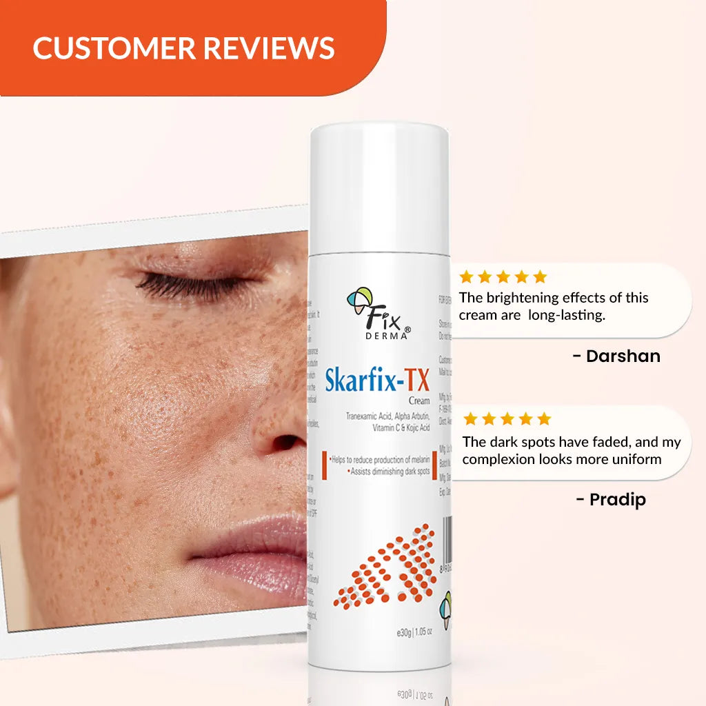 Fix Derma  Skarfix-TX Cream | Effective treatment for melasma and dark spots (30g).