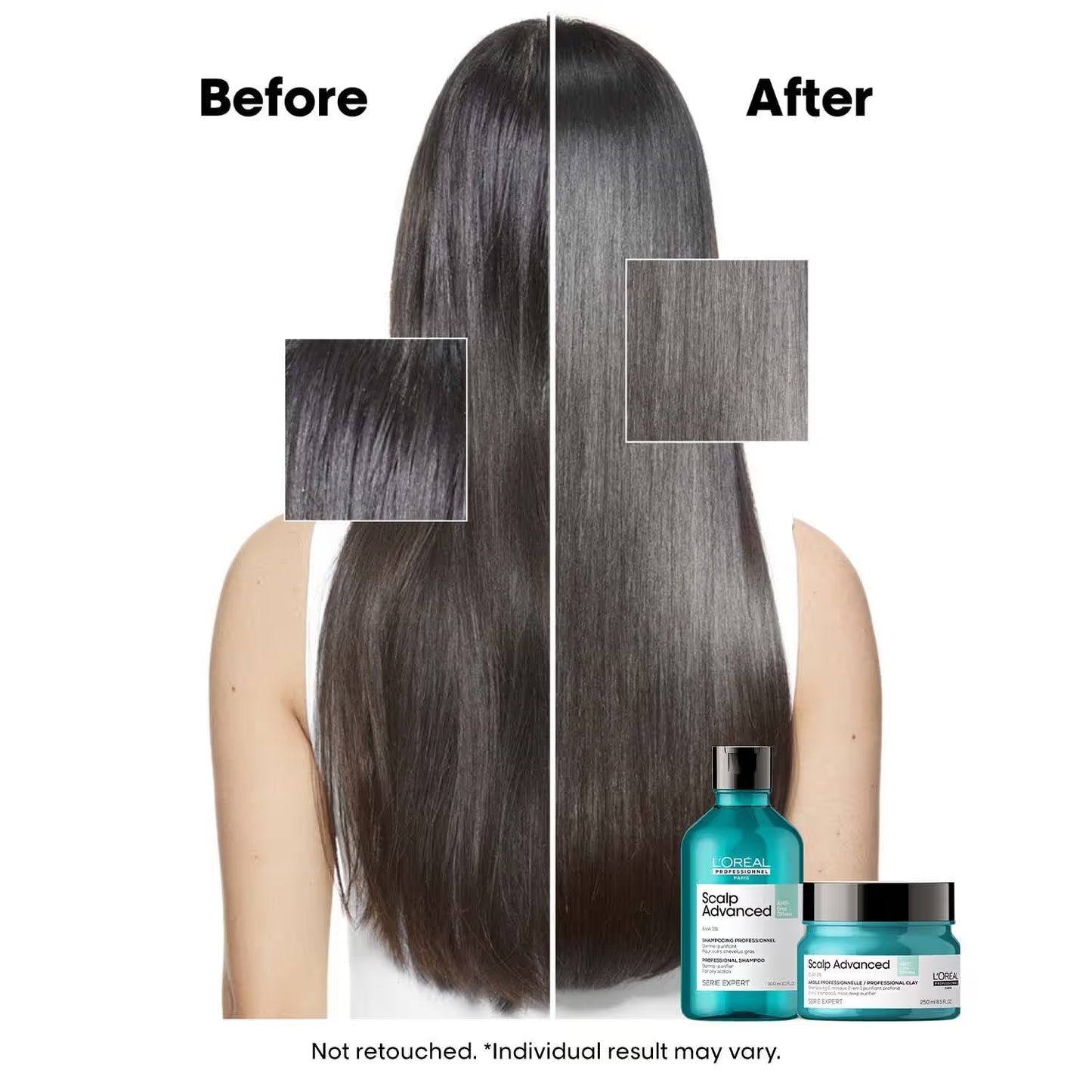 L'OREAL PROFESSIONNEL Scalp Advanced Anti-Oiliness Dermo-Purifier Shampoo (300 ml) for Oily Scalps